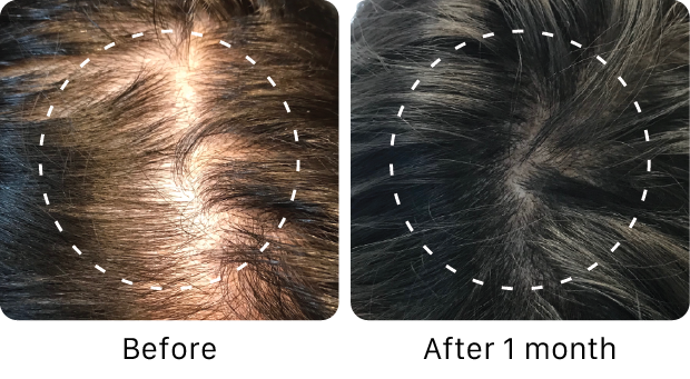 ACTIIV Thickening Hair Serum